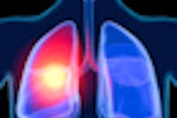 2011 08 30 11 49 20 810 Lungs 70