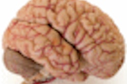 2009 07 30 14 04 27 596 Brain 70