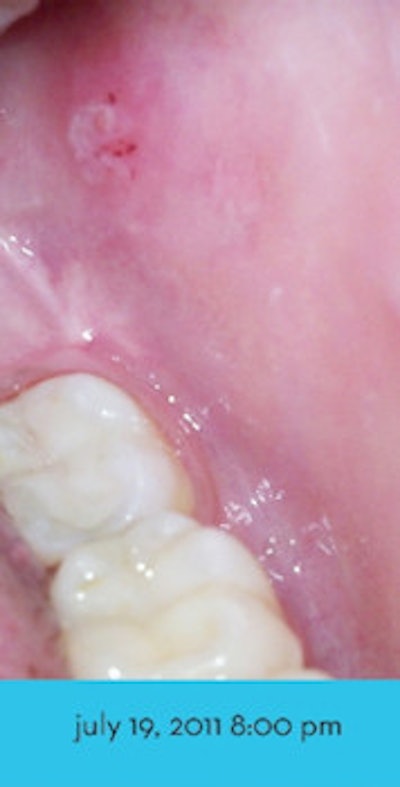 2011 10 18 10 52 53 794 Perio Patch1