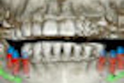 2009 04 27 10 47 12 770 Cbct Thumb 70