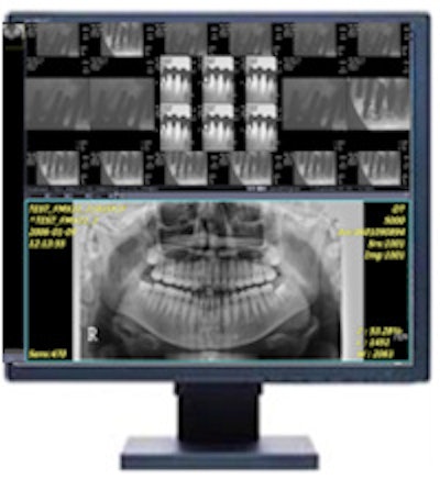 The Infinitt Dental PACS supports cone-beam CT and all other dental imaging modalities, including panoramic, cephalometric, and intraoral sensors, and provides 'always online' storage and multilevel backup. Image courtesy of Infinitt North America.