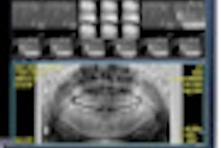 2011 10 25 11 33 08 76 2011 11 11 Pacs Thumb