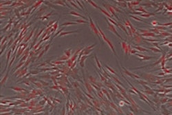 2011 11 08 10 44 22 330 Fop Stem Cell