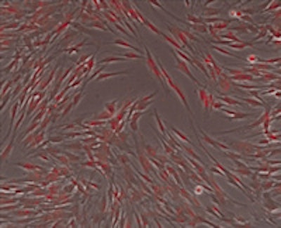 2011 11 08 10 44 22 330 Fop Stem Cell