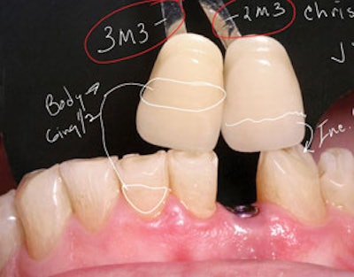 Annotating digital photos can enhance communication with specialists, labs, and even patients.