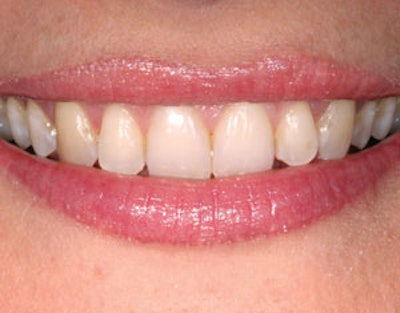 A straightforward image of a patient's smile