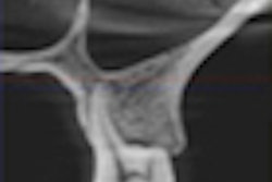 2012 01 23 14 39 41 904 2012 01 24 Cbct Thumb