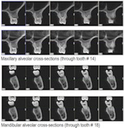 2012 01 23 14 39 42 734 2012 01 24 Cbct Small