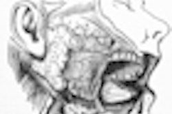 2010 01 21 15 43 33 498 Salivary Glands 70