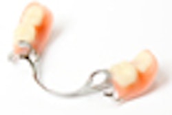 2012 02 09 13 47 22 821 Denture Crown Bridge 70