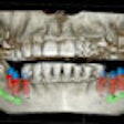 2009 04 27 10 47 12 770 Cbct Thumb 70