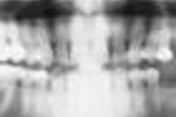 2012 03 28 11 18 58 273 Pan Thumb 2012 03 28 70