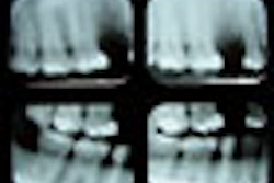 2008 12 16 12 21 44 769 Xrays 70