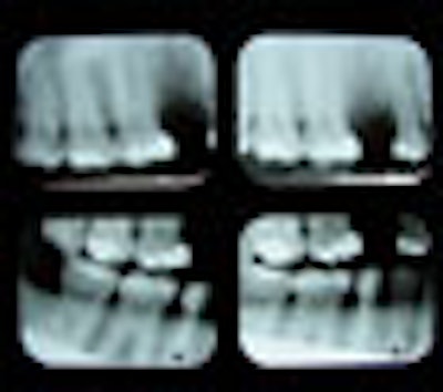 2008 12 16 12 21 44 769 Xrays 70