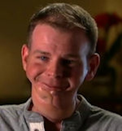 Gruen von Behrens, oral cancer survivor, now travels to schools to warn kids about the dangers of smokeless tobacco. Image courtesy of Campaign for Tobacco-Free Kids.