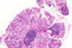 2012 04 13 09 45 13 796 Salivary Gland Biopsy 70