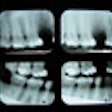 2008 12 16 12 21 44 769 Xrays 70