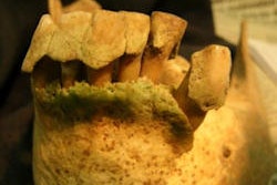 2012 05 03 11 18 59 899 Ancient Dental Calculus 250