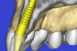 2010 08 27 13 05 53 939 2010 08 27 Cbct Implant Thumb