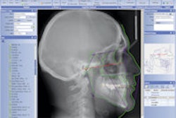 2012 06 05 09 17 23 69 Planmeca Romexis Cephalometric Analysis Thumb