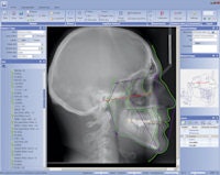 2012 06 05 09 17 23 69 Planmeca Romexis Cephalometric Analysis Thumb