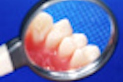 2012 06 26 15 47 28 728 Teeth Mirror2 70