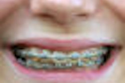 2009 09 17 14 22 39 922 Braces 70