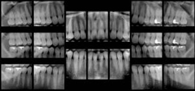 2010 03 30 10 15 18 543 2010 03 30 Tomofig5 Sm