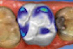 2012 08 17 10 15 19 301 Sirona Omnicam 70