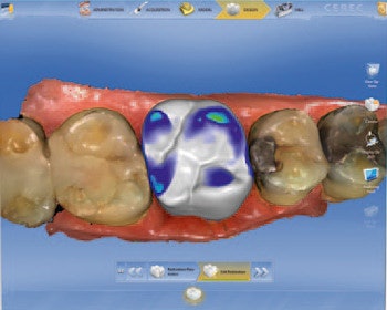 2012 08 17 10 15 19 988 Sirona Omnicam
