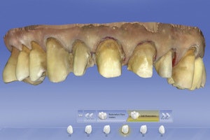 The Omnicam uses a white LED light source