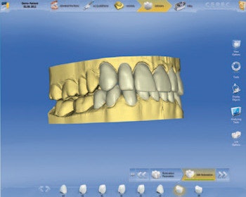 2012 08 17 10 15 21 132 Sirona Bluecam