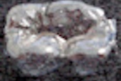 2012 09 21 10 11 21 892 Hydroxyapatite 70