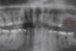 2009 10 14 11 04 50 546 Pano Xray Thumb