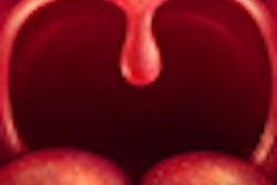 2011 12 21 16 36 48 952 Uvula Tongue Tonsils 70