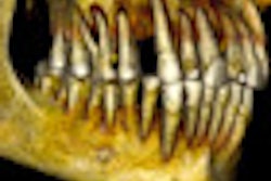 2012 10 30 14 55 58 364 2012 10 31 Mummy Thumb