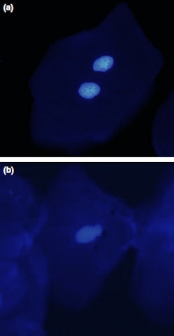 Binucleated and micronucleated cells