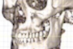 2012 11 16 16 15 53 423 2012 11 16 Chenin Thumb