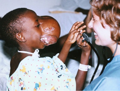 Edoh in 1995 just before her surgery.