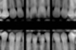 2012 12 17 14 45 41 86 Digital Bitewings 70