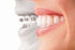 2009 01 30 11 56 34 729 Invisalign 70