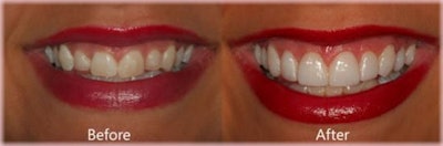 2013 01 09 10 28 57 204 2013 01 09 Image6