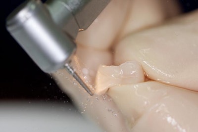 2013 01 09 10 28 59 914 2013 01 09 Image5