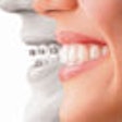 2009 01 30 11 56 34 729 Invisalign 70