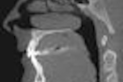2010 11 22 17 07 43 737 Cbct 70