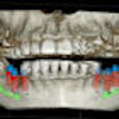 2010 12 02 16 57 31 680 Cbct 3 D 70