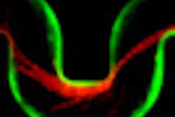2013 03 04 16 29 17 359 2013 03 05 Biofilm 70