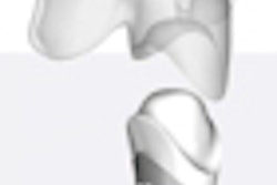 2013 03 19 15 52 12 552 Replicate Tooth 70