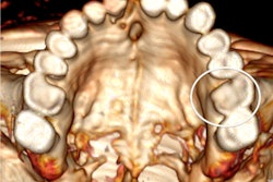 2013 04 09 13 18 18 972 2013 04 09 Iceman2