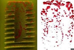 2013 04 09 14 04 09 962 2013 04 09 Slot Bacteria